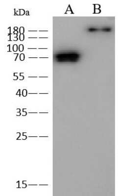 Western Blot: MERS-CoV Spike Protein Antibody [NBP3-18800] - Each lane was blotted with NBP3-18800 at 1:2000 dilution, Goat Anti-Rabbit IgG (H+L)/HRP at 1/10000 dilution as a secondary. Developed using the ECL technique under reducing conditions. Lane A: MERS-CoV Spike Protein (S2 Subunit, aa 726-1296) 5ng. Lane B: MERS-CoV Spike Protein (S1+S2 ECD, aa 1-1297) 5ng.